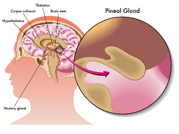 dysfonctionnement de la glande pinéale et maladie neurologiques